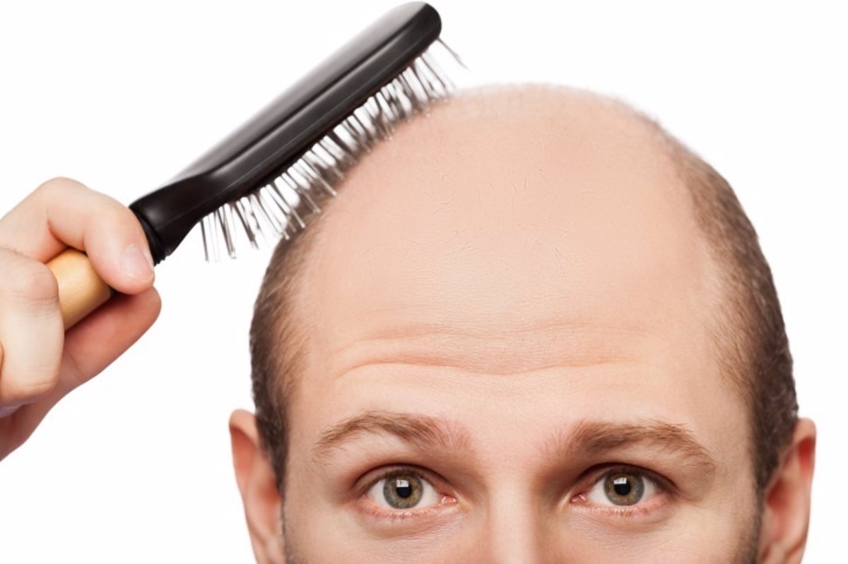 Mitos-y-verdades-sobre-la-caida-del-cabello.-hombre-calvo-con-cepillo-en-la-cabeza-intentando-peinarse